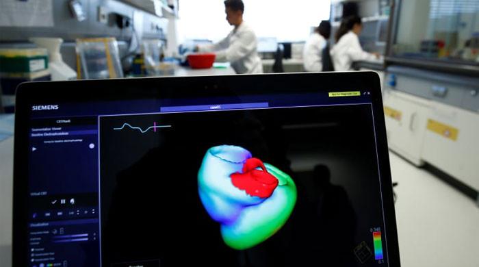 Revolutionary AI Tech Identifies Hidden Heart Attack Risks