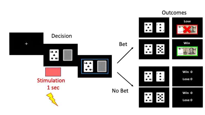 Research team models impulsivity and risk aversion using deep brain stimulation