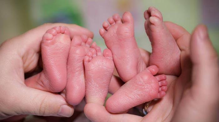 Why is rate of triplet births declining in US Pakistan News Today