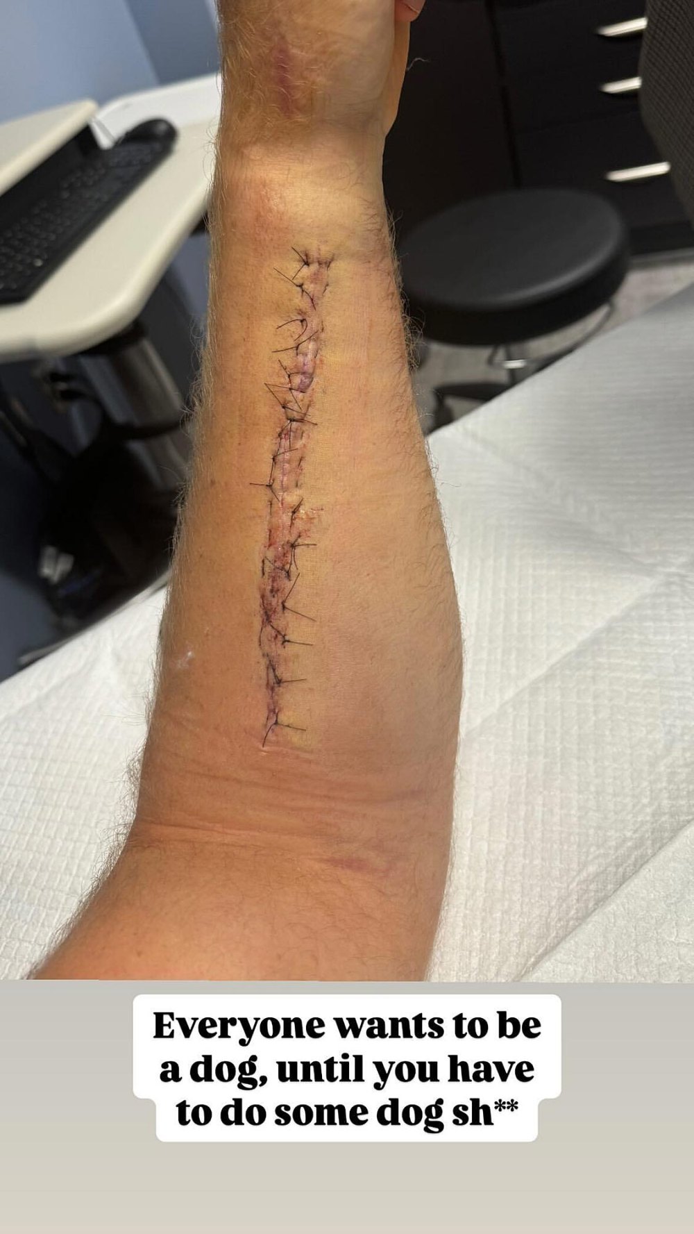 Detroit Lions LB Alex Anzalone Shares Gnarly Picture of Broken Forearm