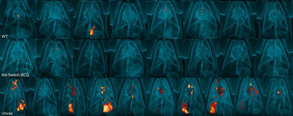 Self destructing vaccine offers enhanced protection against tuberculosis in monkeys Pakistan News Today